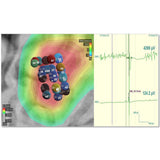 visor2 Neuronavigation - TMS Pulse Locations | Caputron