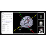 Neural Navigator - MEP Screen | Caputron