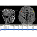 visor2 Neuronavigation - Target Definition | Caputron
