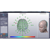 Soterix HD-Targets NeuroTargeting Software | Caputron